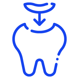 dental-fillings